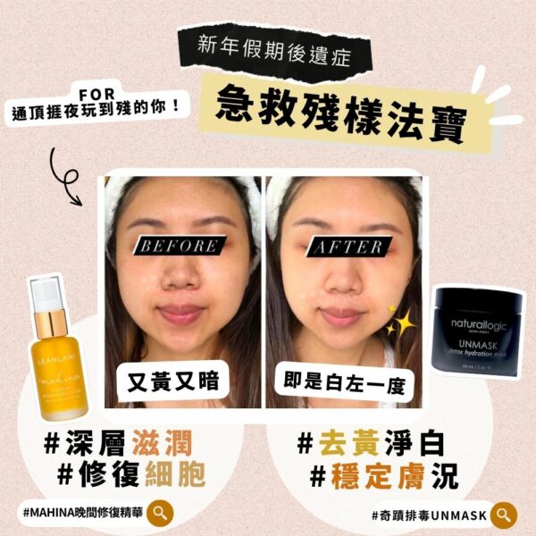 排毒淨白消痘，細胞再次重生！Naturallogic奇蹟排毒UNMASK 50ml - Image 2