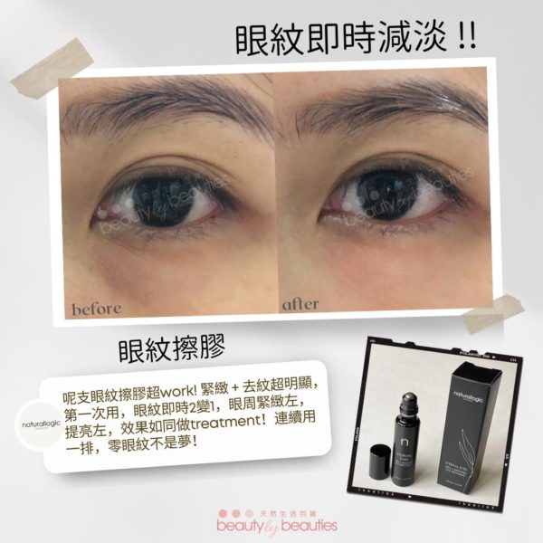 眼紋擦膠