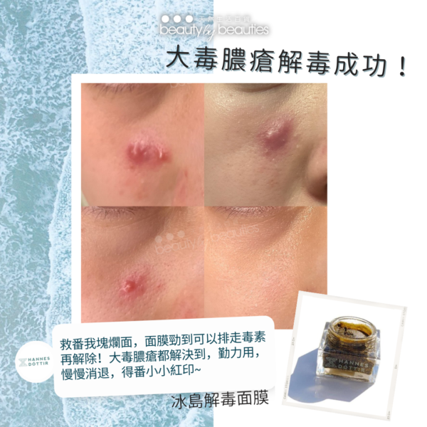 解毒面膜