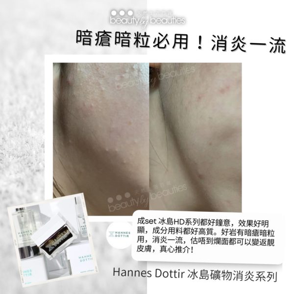 Hannes Dottir解毒膜