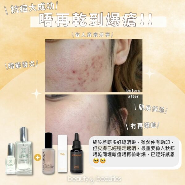 強效消炎謝暗瘡，即時緊緻抗皺！Afrakari RENEWAL 生物肽亮肌重生油 30ml - Image 4
