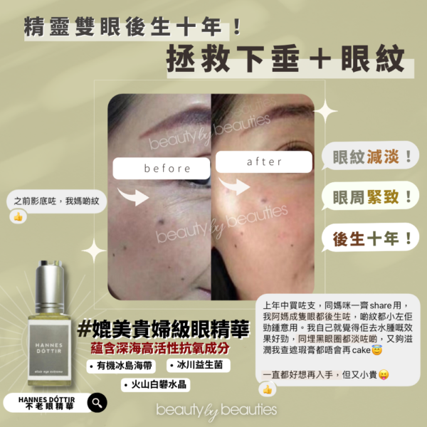 【9折】最有效提拉去水腫，拯救下垂眼！Hannes Dóttir 不老眼精華 15ml - Image 4