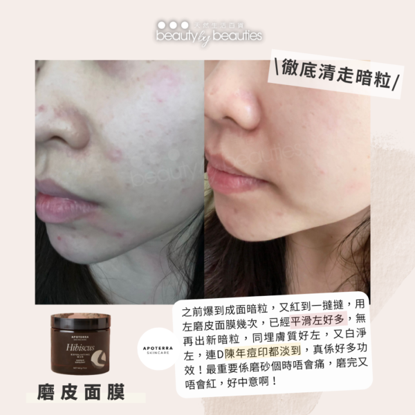磨皮面膜