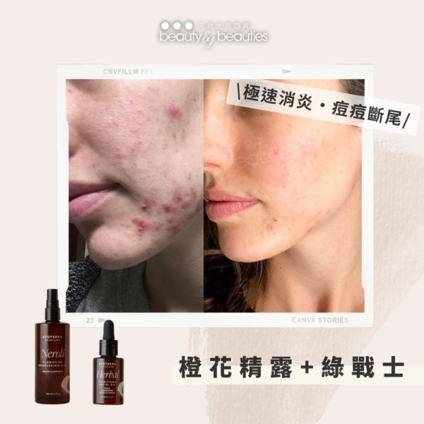 橙花精露+Herbal綠戰士