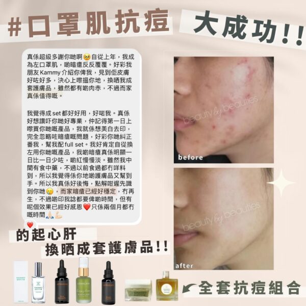 強效消炎謝暗瘡，即時緊緻抗皺！Afrakari RENEWAL 生物肽亮肌重生油 30ml - Image 2