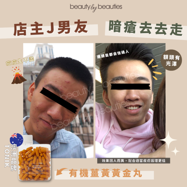 抗炎、抗老、抗痘！ToNIK有機薑黃黃金丸(120粒) - Image 5