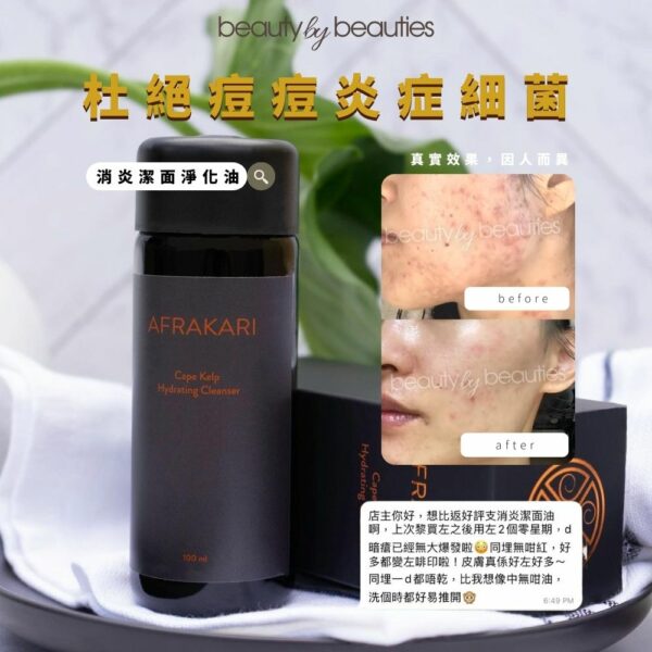 痘痘一洗即消，Afrakari消炎潔面淨化啫喱100ml - Image 2