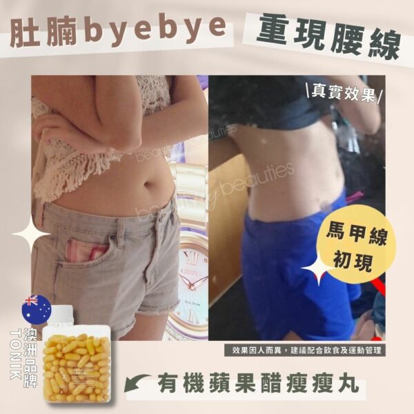 【72折】【白瘦美3個月套裝】 TONIK瘦瘦丸3樽 + TONIK彈彈丸3樽 + DAYS OF CONFIDENCE 美白小橙丸3樽 - Image 2