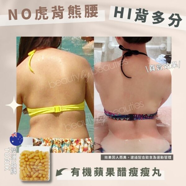 【會員兌換禮物】ToNIK有機蘋果醋瘦瘦丸5日試食裝(10粒，必須以積分兌換後才會發送) - Image 5