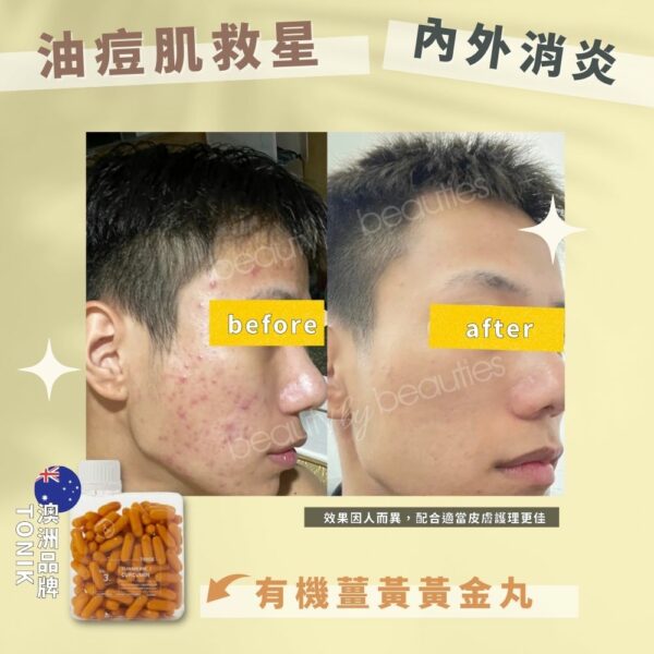 抗炎、抗老、抗痘！ToNIK有機薑黃黃金丸(120粒) - Image 6
