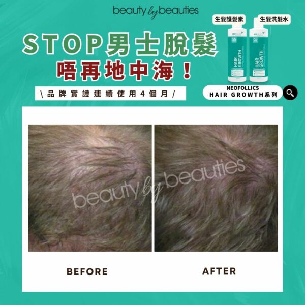 【限時半價】強韌髮絲，減少斷裂！Neofollics 純素激活髮量護髮素 250ml - Image 3