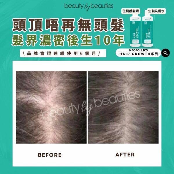 【限時半價】強韌髮絲，減少斷裂！Neofollics 純素激活髮量護髮素 250ml - Image 2