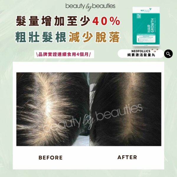 激活增髮，重整頭皮生態環境！Neofollics 純素激活髮量丸（100粒） - Image 4