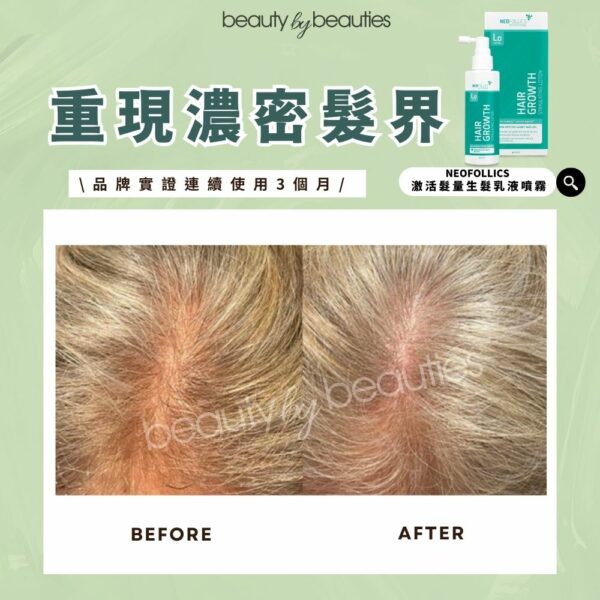 【限時半價】不油不笠，髮量大增！Neofollics 激活髮量生髮乳液噴霧90ml - Image 4