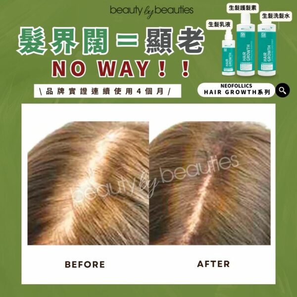 【限時半價】不油不笠，髮量大增！Neofollics 激活髮量生髮乳液噴霧90ml - Image 5