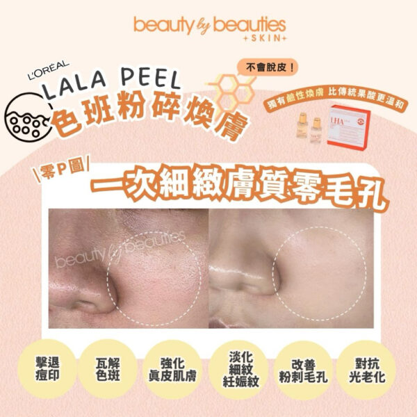 【首次體驗價】無印無斑又白滑！LALA PEEL色素痘印粉碎療程－全面 (可即時配搭高能量療程） - Image 3