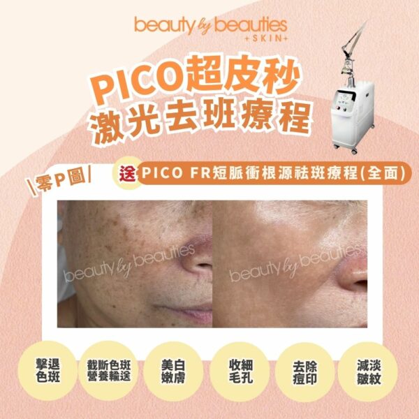 【首次體驗價】色班全清術！PICO超皮秒激光祛斑療程(全面) - Image 3