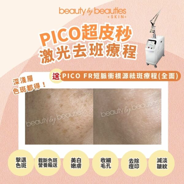 【首次體驗價】色班全清術！PICO超皮秒激光祛斑療程(全面) - Image 2